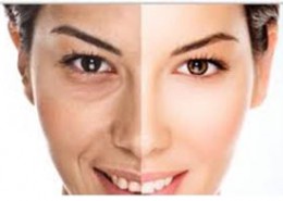 جوان سازی پوست