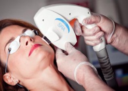 لیزر موهای زائد